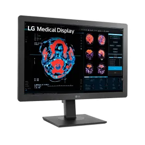 Monitor Lgx 24INCH 2MP Ips Diagnostic — LG